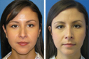 Before & After Photos